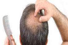 کلینیک تخصصی کاشت مو هور